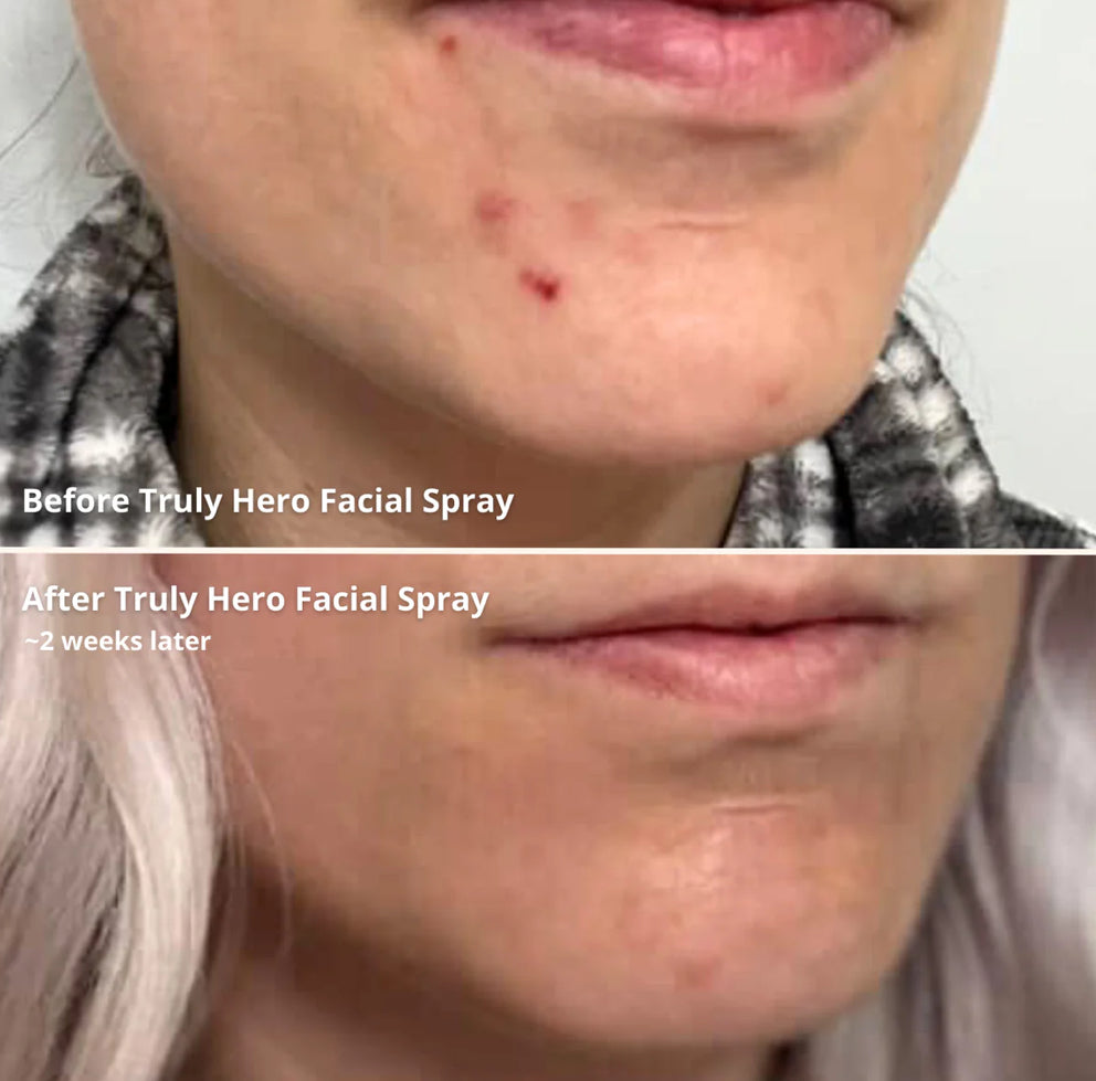 Truly lifestyle brand~ Hero facial spray
